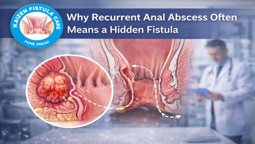 Why Recurrent Anal Abscess Often Means a Hidden Fistula?