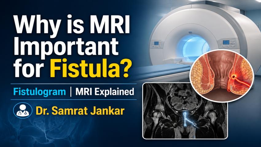 Why is MRI Important for Fistula? Fistulogram MRI Explained