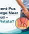 Persistent pus discharge near the anus and anal fistula symptoms