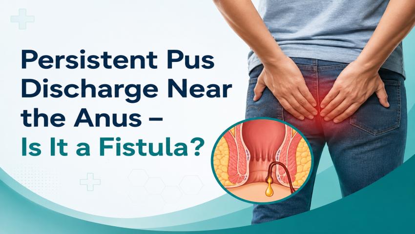 Persistent Pus Discharge Near the Anus – Is It a Fistula?