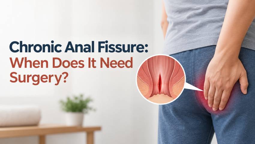 Chronic Anal Fissure: When Does It Need Surgery?