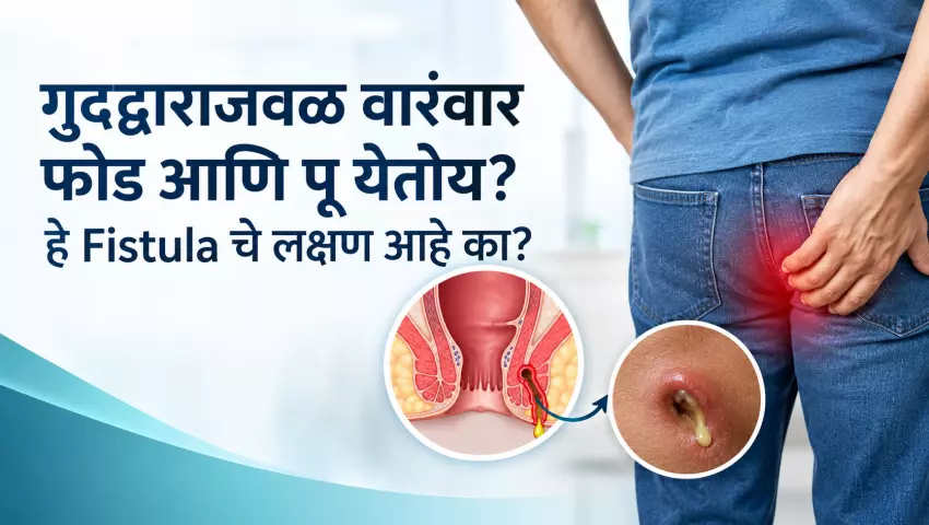 Are boils and pus appearing repeatedly near the anus? Could this be a sign of a fistula?