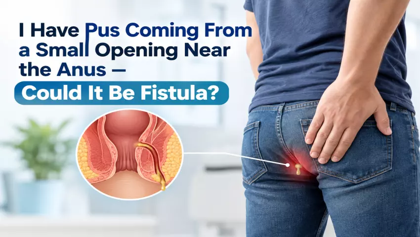 I Have Pus Coming From a Small Opening Near the Anus Could It Be Fistula?